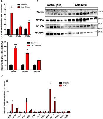 Significance of the Wnt signaling pathway in coronary artery atherosclerosis